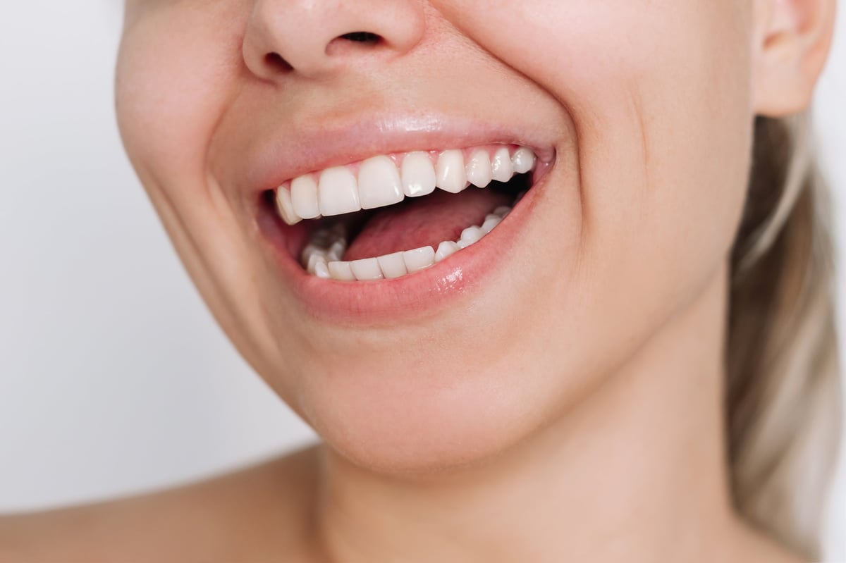 Cropped shot of a young woman with perfect white even teeth on a white background, showcasing teeth whitening results